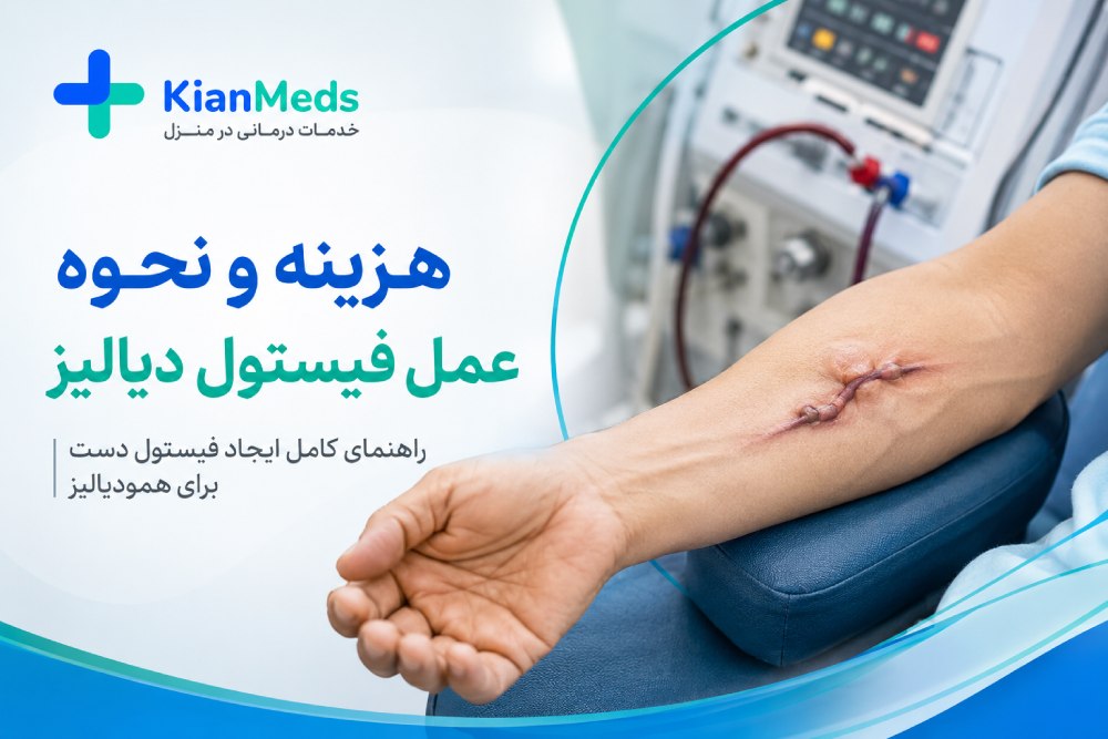 هزینه عمل فیستول دیالیز ۱۴۰۵ + نحوه گذاشتن فیستول دست