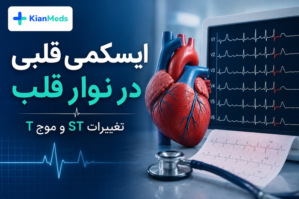 ایسکمی قلبی در نوار قلب، تغییرات ST و موج T