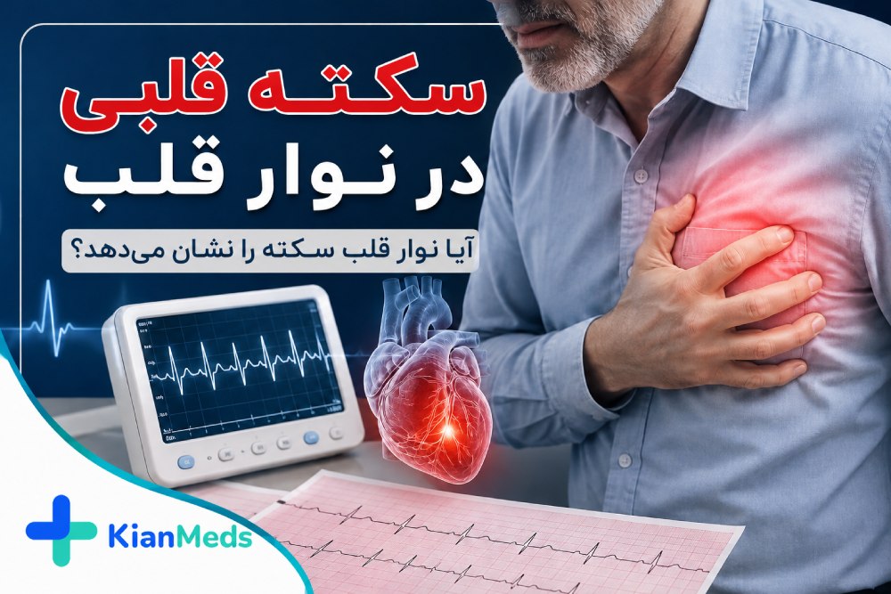 سکته قلبی در نوار قلب؛ آیا ECG سکته قلبی را نشان می‌دهد؟