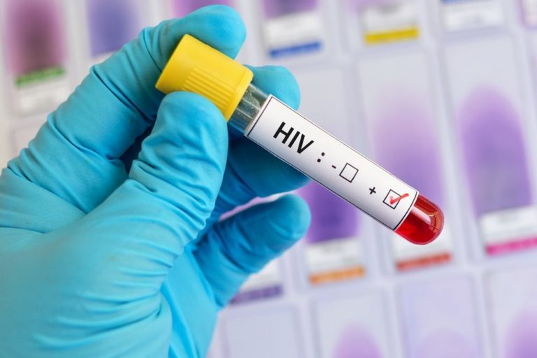 علائم ایدز | با اولین رابطه جنسی به hiv مبتلا می شویم؟