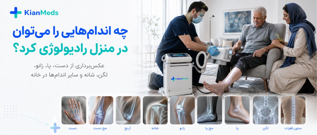 رادیولوژی شکستگی و اندام‌ها