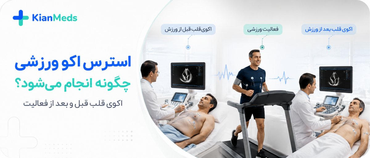 استرس اکو چیست و چه تفاوتی با تست ورزش دارد