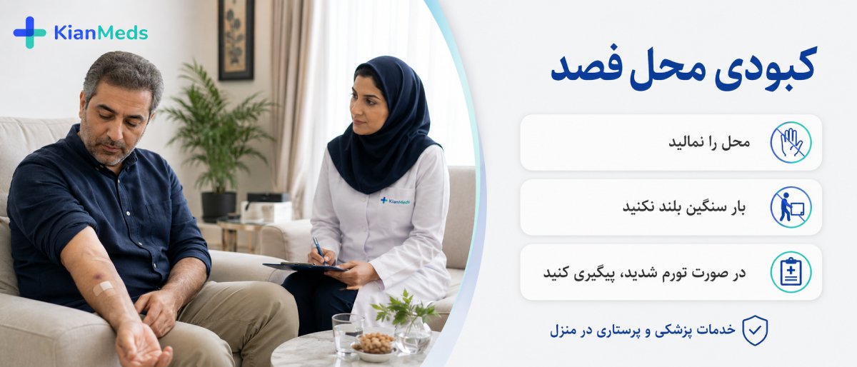 کبودی بعد از فصد خون