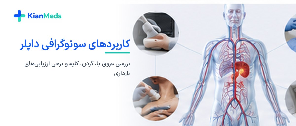 سونوگرافی داپلر چیست