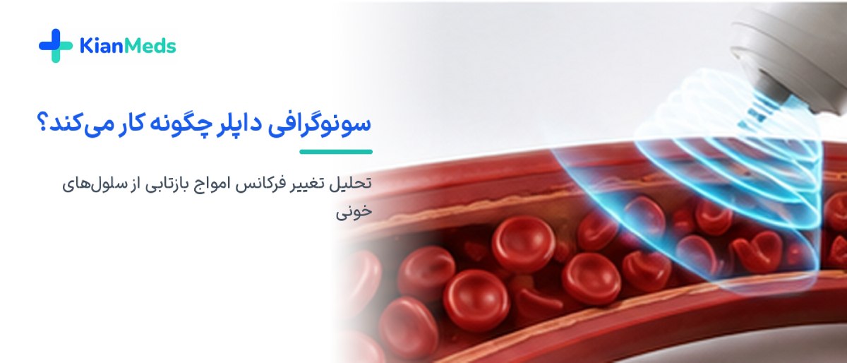 سونوگرافی داپلر چیست