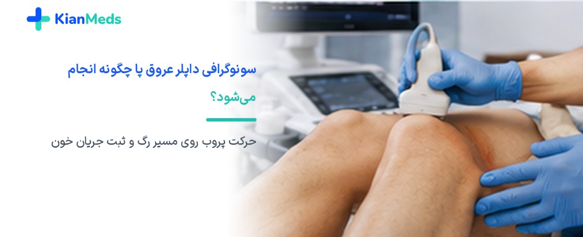 سونوگرافی داپلر چیست