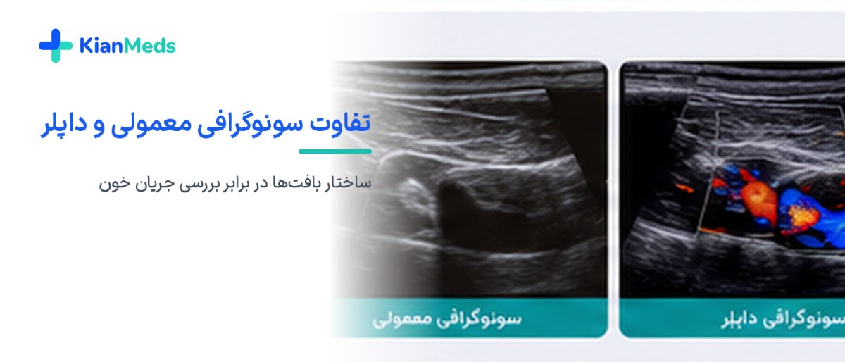 سونوگرافی داپلر چیست