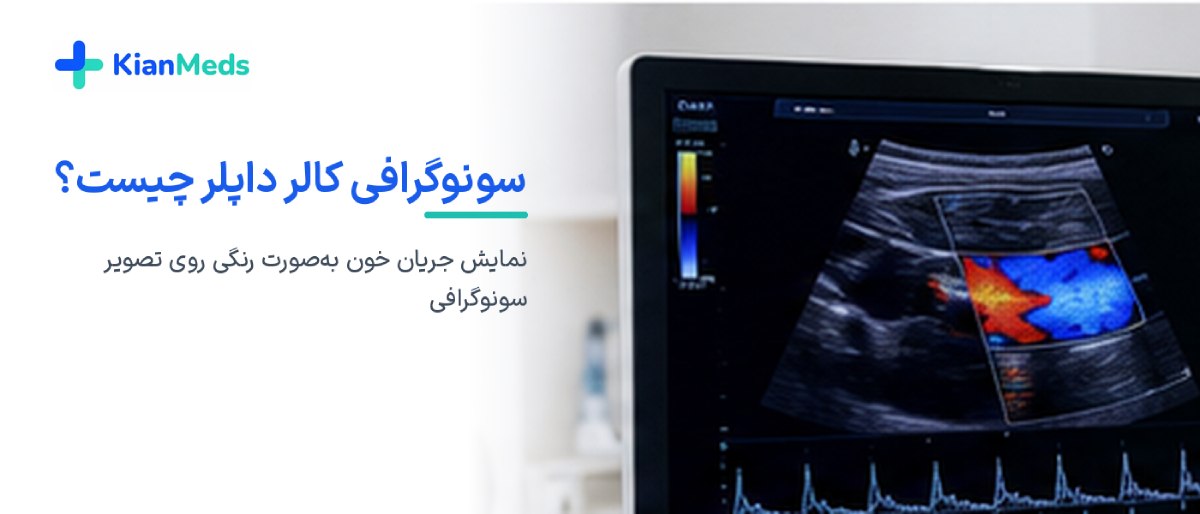 سونوگرافی داپلر چیست