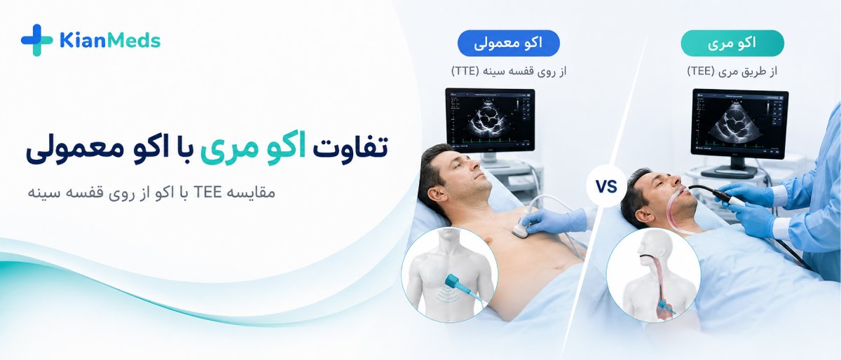 اکو مری قلب