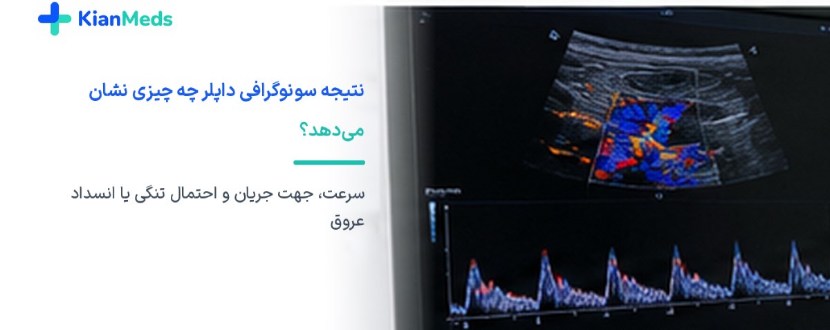 سونوگرافی داپلر چیست